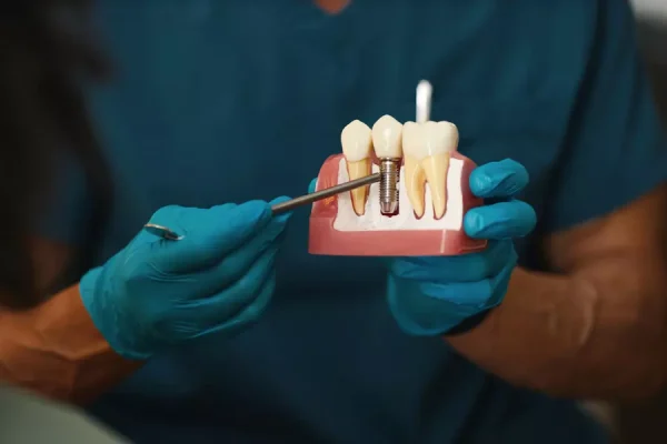 Best Dental Clinic in Edappally | Dental care kochi